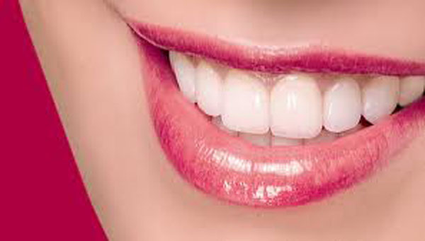 Hollywood Smile